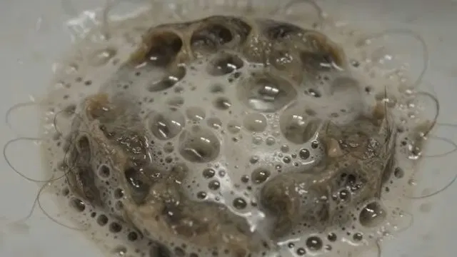 Hair Clog Caught In Sink Strainer shown for Should a Dallas, GA Home on Septic Even Have a Garbage Disposal? in Dallas, Georgia.